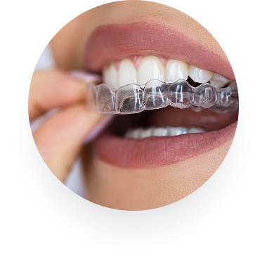 Invisalign®