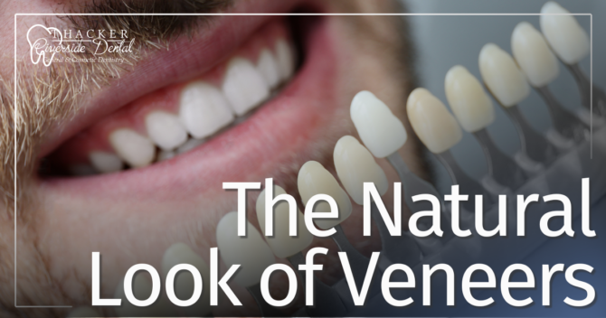 The Natural Look of Veneers Male smile